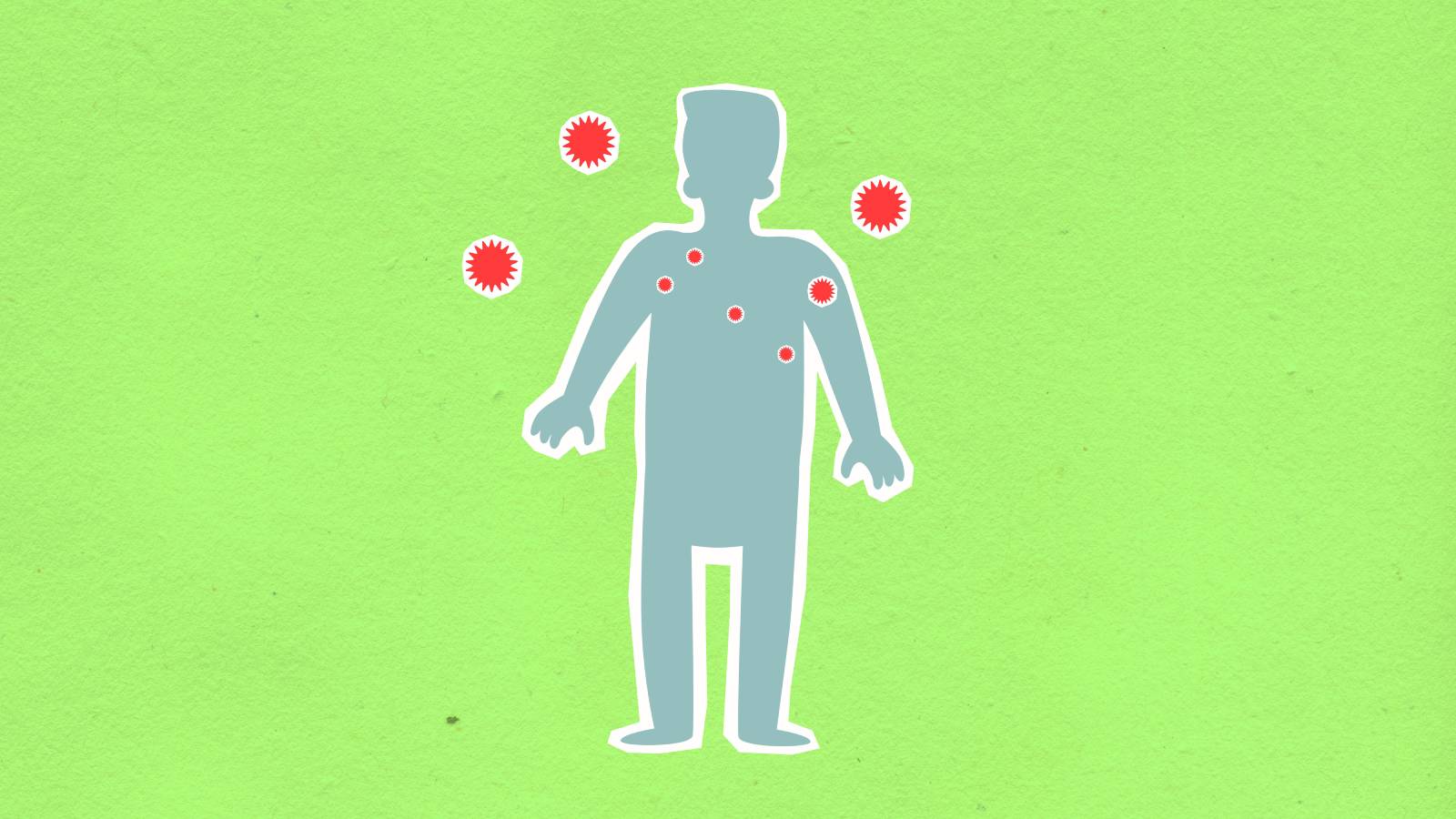 France reports first known human case of Shamonda virus