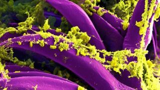 Russia denies second infection in suspected pneumonic plague case
