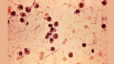 Kochi restaurant under scanner as three Shigella cases confirmed after food poisoning
